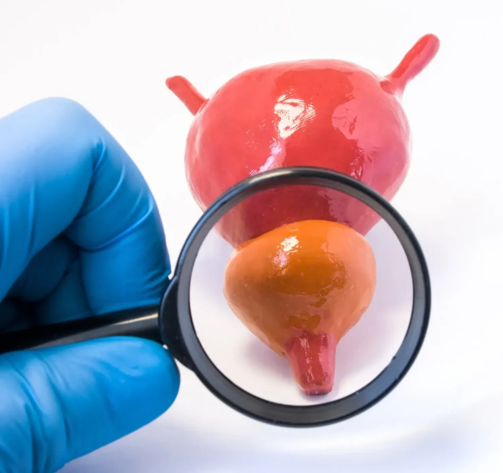 Prostate & BPH Treatment in Thane